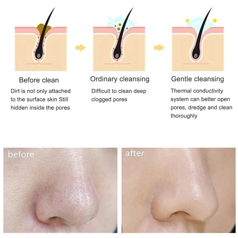Waterproof Electric Facial Cleansing Brush
