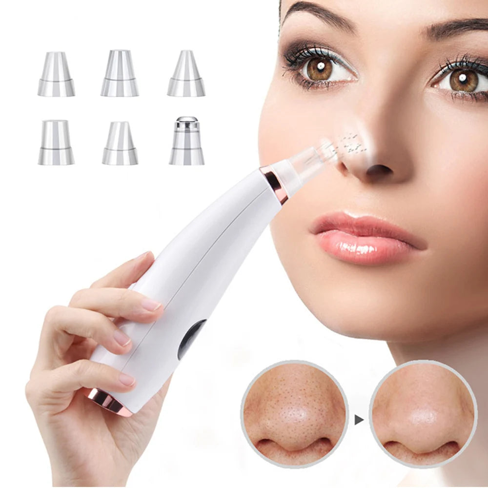 Electric Blackhead & Pore Cleaner