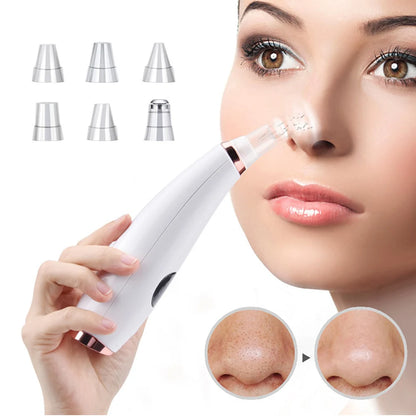 Electric Blackhead & Pore Cleaner