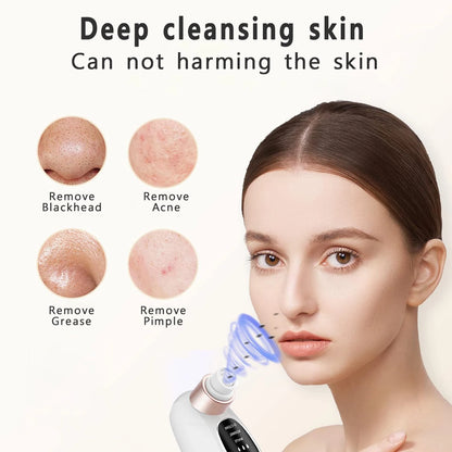 USB Rechargeable Blackhead Remover Vacuum