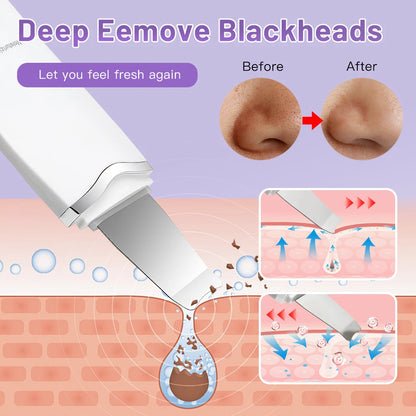 Ultrasonic Skin Scrubber Face Spatula