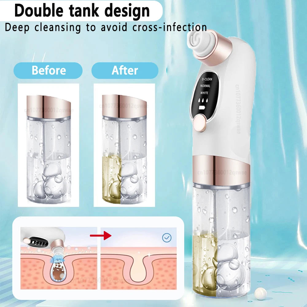 USB Rechargeable Blackhead Remover Vacuum