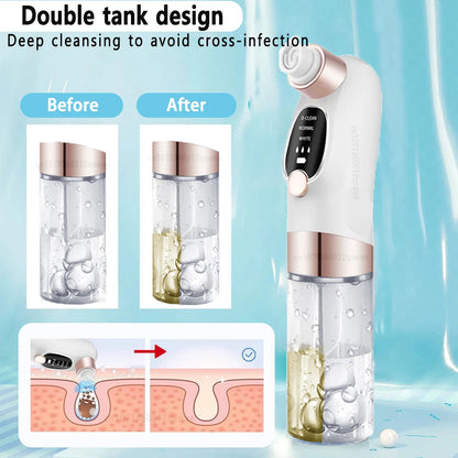 USB Rechargeable Blackhead Remover Vacuum