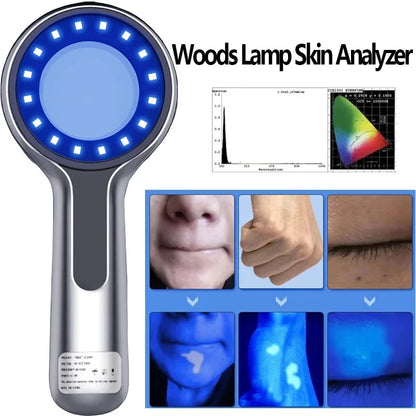 New Wood’s Lamp Skin Analyzer