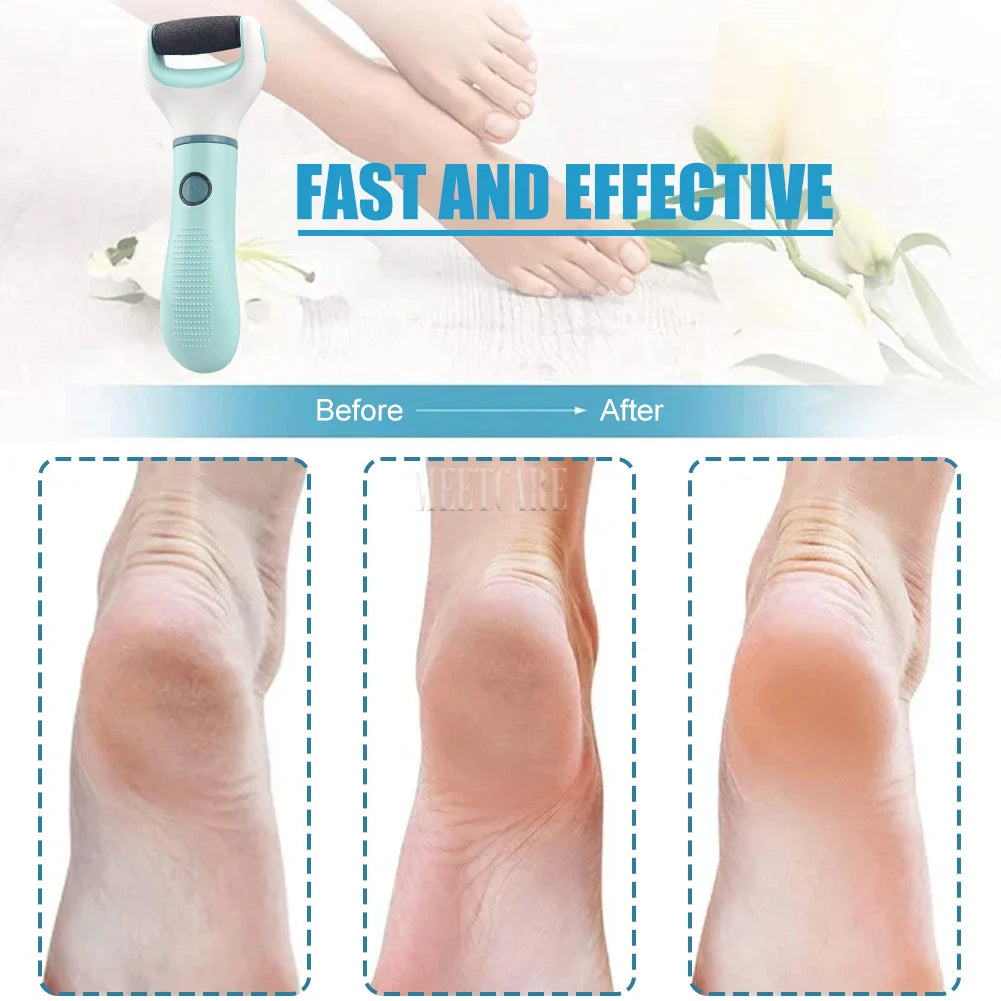 Electric Waterproof Foot Callus Remover