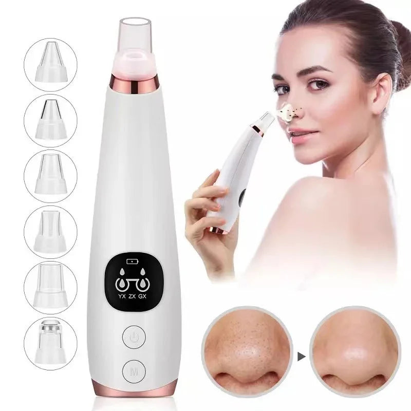 Electric Blackhead & Pore Cleaner