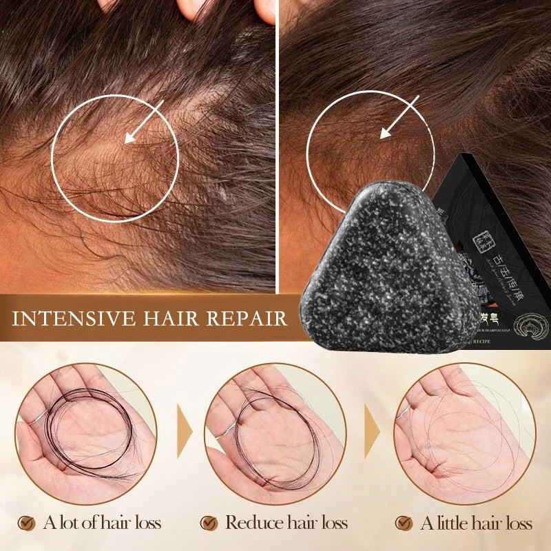 Natural Black Hair Growth Shampoo Bar