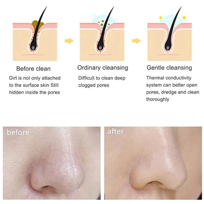 Waterproof Electric Facial Cleansing Brush