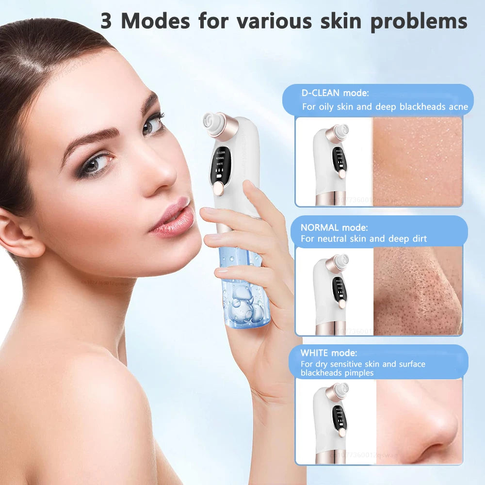 USB Rechargeable Blackhead Remover Vacuum