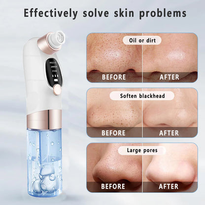 USB Rechargeable Blackhead Remover Vacuum