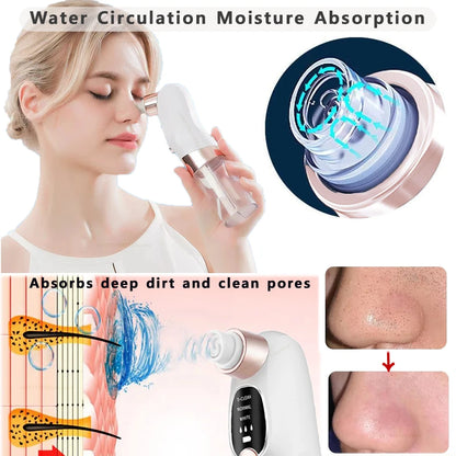 USB Rechargeable Blackhead Remover Vacuum